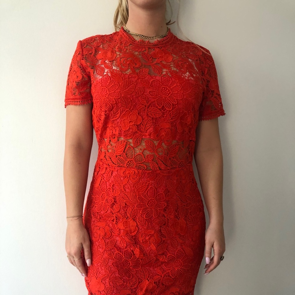 Lovers+Friends Lace Dress
